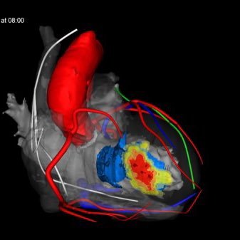 MUSC Electrophysiology