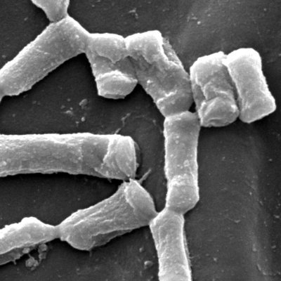 Microbial ecology in crop production; plant disease and Fusarium mycotoxins