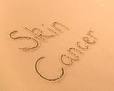 Get your skin cancer article here