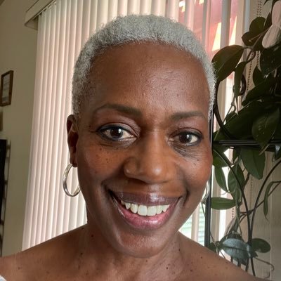 Joye M Carter, MD, PhD, Profile