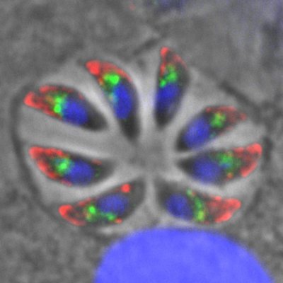 French Research lab led by Dr. Cyrille Botté with major focus on lipid synthesis/trafficking/signalling and metabolism in Toxoplasma, malaria, infectious agents