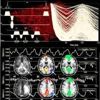 Official account of the Functional Neuroimaging and Brain Perfusion research team, located in the Grenoble Institut Neurosciences, France