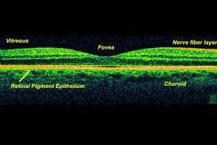 Retinal Surgeon at Nottingham University Hospital UK