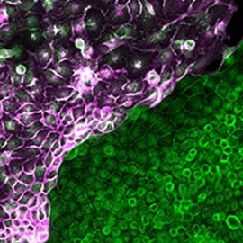 Cell biologist focused on understanding epithelial tissue health & early tumours. Early detection of pancreatic and lung cancers. My own views.