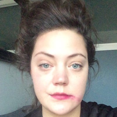 cattyschmidt's profile picture. Kronisk morgengretten.