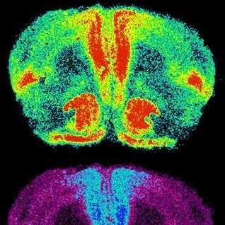 Emory Neuroscience PhD Program Profile