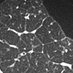 Imagen Cardiotorácica H.U. Bellvitge (@ict_hbellvitge) Twitter profile photo Imagen Cardiotorácica H.U. Bellvitge (@ict_hbellvitge) Twitter profile photo