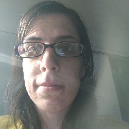 I have epilepsy since I was three weeks old
