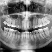 Ray VanKleef (@xray) 's Twitter Profile