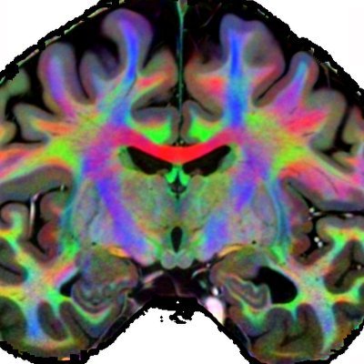 Caress the Detail: A Comprehensive MRI Atlas of the in Vivo Human Brain