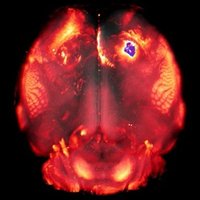 UCL Brain Cancer (@ucl_braincancer) 's Twitter Profile Photo UCL Brain Cancer (@ucl_braincancer) 's Twitter Profile Photo