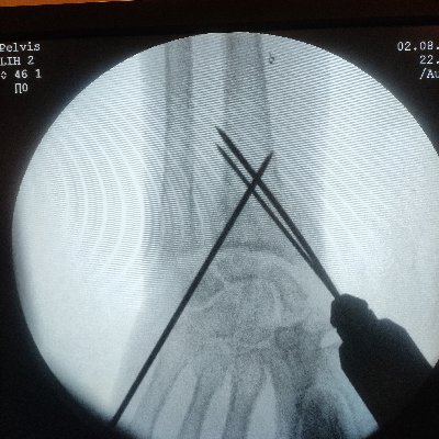 DrRavitejareddy's profile picture. Orthopaedic Surgeon, Bhagvan Satya Sai Follower.