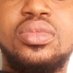 St. Dziedzorm BSc. MD 🇬🇭🇨🇺 (@geenaeus) Twitter profile photo St. Dziedzorm BSc. MD 🇬🇭🇨🇺 (@geenaeus) Twitter profile photo