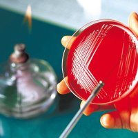 State Hygienic Laboratory at the University of Iow (@hygieniclab) 's Twitter Profile