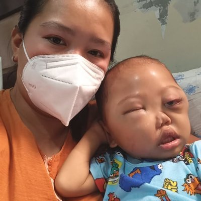 Knocking in your kind hearts.. baby ace needs immediate chemotherapy and hospitalization. Please pray for him and share this link https://t.co/TZGfObcUfx