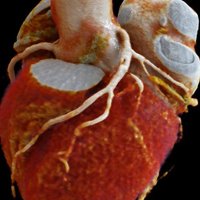 Emory Cardiothoracic Imaging & AI Lab (@heart_ai_lab) 's Twitter Profile