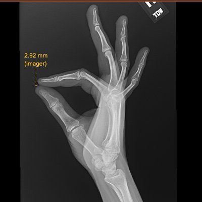 BioXray10's profile picture. Just an X-ray machine.