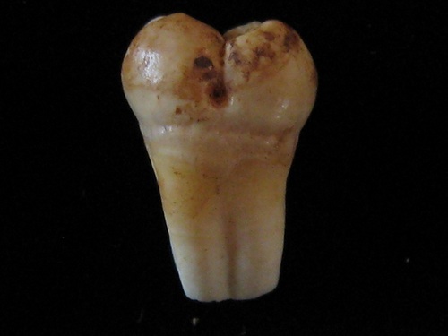 PhD student at the University of Otago, specialising in dental anthropology