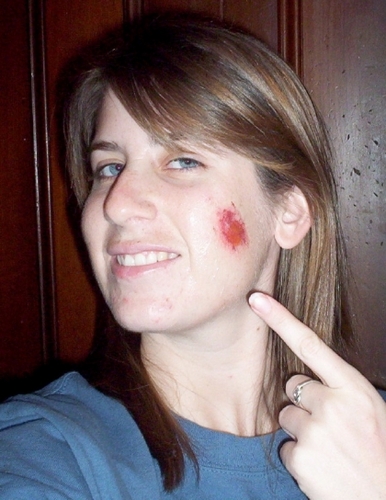 TurgidPustule's profile picture. 