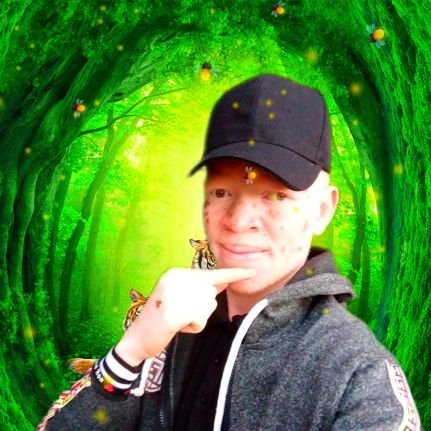 GemosEmma's profile picture. medical student at Jerusalem school of nursing and midwifery lira Uganda 🇺🇬🇺🇬🇺🇬🇺🇬🇺🇬🇺🇬🇺🇬🇺🇬🇺🇬🇺🇬🇺🇬🇺🇬