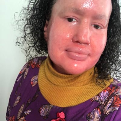 carlyfindlay Profile Picture