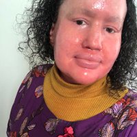 Carly Findlay OAM (she/her)(@carlyfindlay) 's Twitter Profile Photo