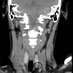 Head & Neck Imaging Collections (@hnimaging) Twitter profile photo Head & Neck Imaging Collections (@hnimaging) Twitter profile photo