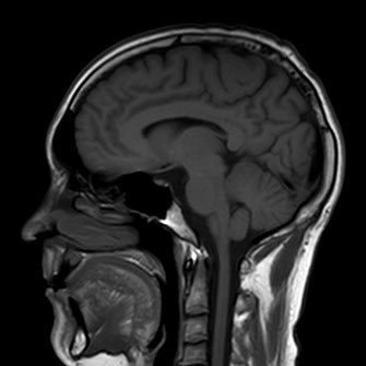 I am an academic at the Royal Veterinary College. My research focuses on how mutations in the LRRK2 gene cause Parkinson's disease.