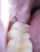 AfterTeeth's profile picture. 