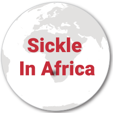 SickleInAfrica=Sickle Pan-African Research Consortium (SPARCo)|, SickleAfrica Data Coordinating Center (SADaCC)|, Sickle Pan-African Network (SPAN)| #SickleCell