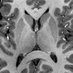 DavidCarmichael_Neuroimaging (@DNeuroimaging) Twitter profile photo