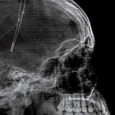 MrDStCyrKing's profile picture. I'm here for the knowledge.