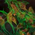 Inserm UMR 1069 N2COx (@inserm_n2c) Twitter profile photo Inserm UMR 1069 N2COx (@inserm_n2c) Twitter profile photo