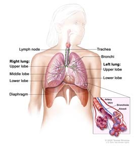 General Malignant Mesothelioma Information, cellular classification, pleural mesothelioma, stages of malignant mesothelioma and more.