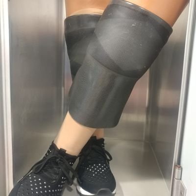 I am double amputee since October 2018.
My life and my journey of acceptance through sheer determination