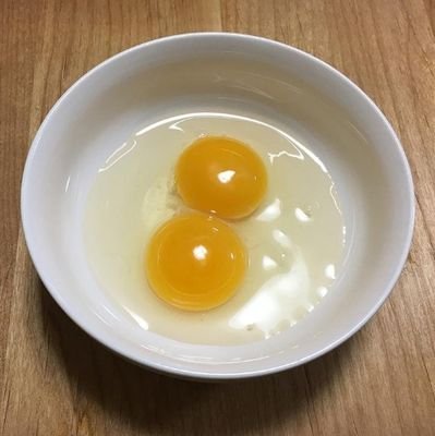 2020年8月下旬に双子出産!
なぜか健診の補助券余った(笑)
約3000gと約2500gの🦖🦖誕生
(38週1日目で予定帝王切開)
次男坊だけ1日保育器に。
義祖母が嫌い、ほぼ縁切りしたよ😇
2022年5月より復職🧑💻