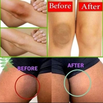 Skin Brightening Products