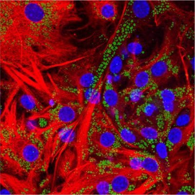 A large bunch of scientists studying Chaperone Mediated Autophagy at Albert Einstein College of Medicine @einsteinmed *tweets and views are our own*