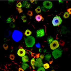 Laboratory investigating pain and sensory mechanisms, led by Prof Jason Ivanusic @UniMelbMDHS