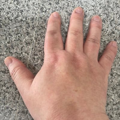 15年近く、うつ病と闘いながら、プログラマーを30年以上続けてきた。向精神薬の副作用で、2022年から、遅発生ジスキネジアになり、不随運動の痙性斜頸の振戦の為、生活も仕事も困難になりました。向精神薬による副作用の遅発性ジスキネジアを知ってもらい「向精神薬による副作用、遅発生ジスキネジアを防ごう」 という活動を行います。