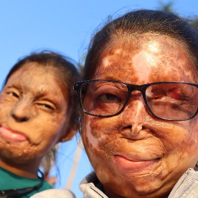 StopAcidAttacks Profile Picture