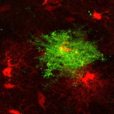 Neuroscience lab at @InstitutoCajal focused on synaptic plasticity and astrocyte-neuron interactions.