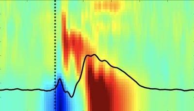 Deconstructing brain stimulation to build personalized treatments for mental health disorders. PI: @DrCoreyKeller | @StanfordPsy @StanfordMed @StanfordBrain