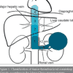 IVC Thrombus (@ivcthrombus) Twitter profile photo IVC Thrombus (@ivcthrombus) Twitter profile photo
