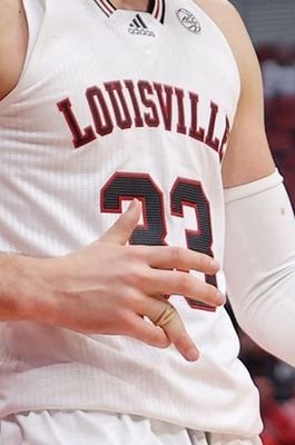 Matt's big bro to his broken finger...