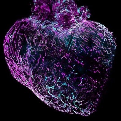 #Endothelium #Valvulopathy #HeartFailure | @Inserm @CHURouen @UnivRouen | https://t.co/5RHUNdt6hB