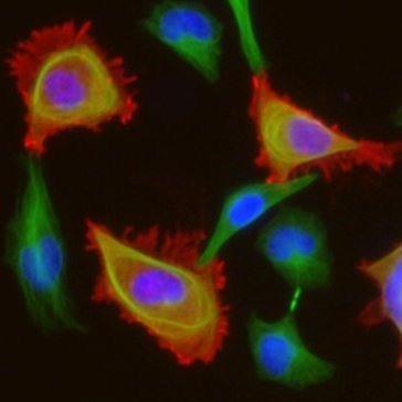 The Didonna Lab aims at understanding the mechanistic connection between aberrant immune responses and neurodegenerative processes in chronic human diseases.