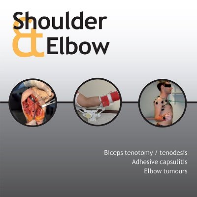 Shoulder & Elbow is devoted to the advancement of the science of diagnosis and management of shoulder and elbow disorders. Shoulder & Elbow is the BESS Journal.