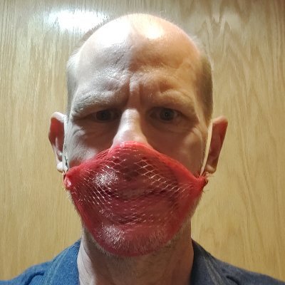 ToddRAllen1's profile picture. I have SBMA often misdiagnosed as ALS, 50 CAG repeats in AR gene. Reversed symptoms on keto with nightly strength training in sauna.  LMHR enjoying rising LDL&T