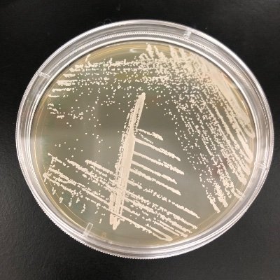 Fighting fungi in the lab of Dr. Karen A. Norris at the University of Georgia